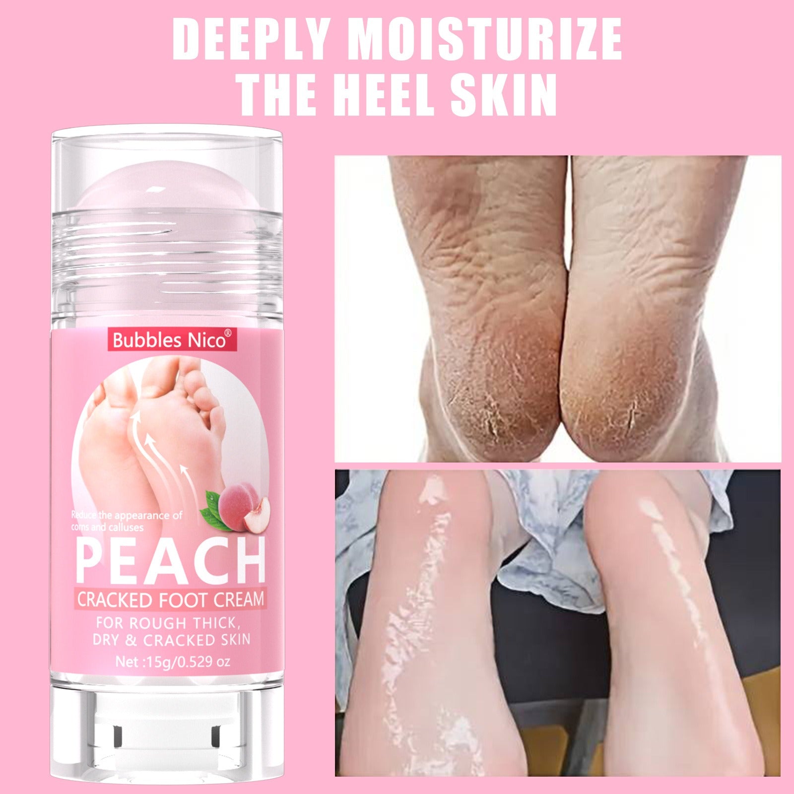 Foot care stick deeply moisturizes rough cracked heel skin